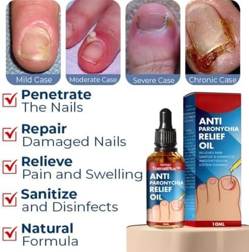 Tratamiento Antihongos para Uñas